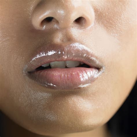 Why Am I Getting White Spots On My Lips - Infoupdate.org