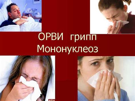 ОРВИ грипп Мононуклеоз