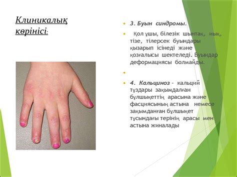 Дерматомиозит - презентация онлайн