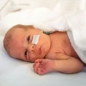 A Weekly Look at Premature Babies: Complications and Care - Nightingale Night Nurses