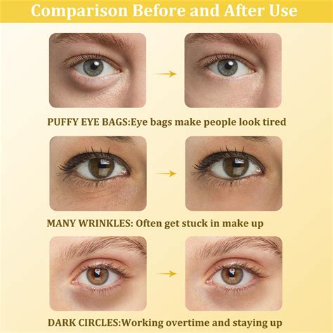 eye patches collagen  eye mask dark circles  eye