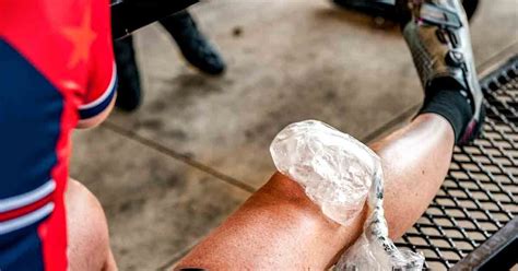 knee contusion recovery  treatment