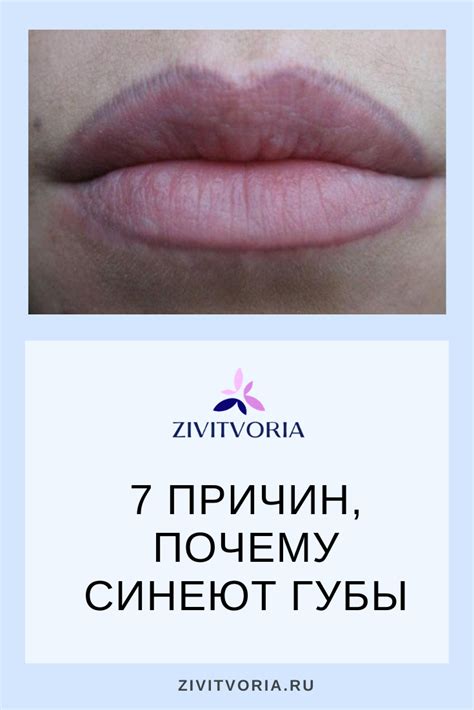 Причины, почему губы становятся синими. В каких случаях обращаться к ...