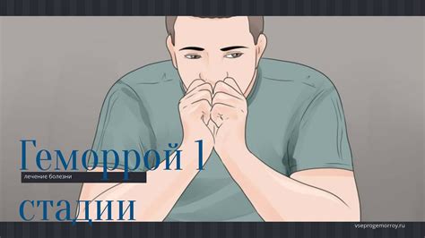 Геморрой 1 стадии - YouTube