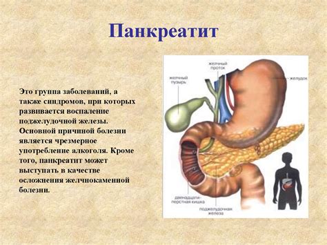 Заболевания пищеварительной системы - презентация онлайн