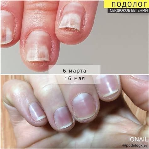 До-После — Подолог Киев