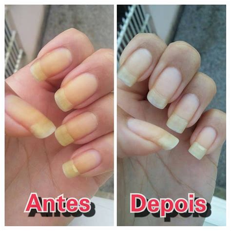 Como Tirar O Amarelado Das Unhas