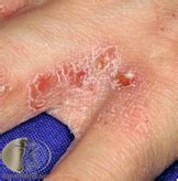 uworld step  assessment  review flashcards quizlet