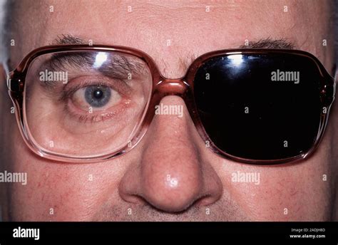 Double vision treatment. 68-year- old man with a patch over one of the ...