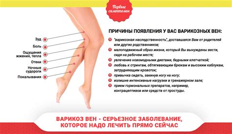 Болят ступни ног: причины, что делать, как лечить боли, к какому врачу ...