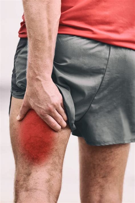 Hamstring Healing: A Comprehensive Guide to Swift and Safe Recovery ...