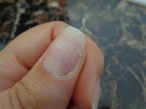 7 Easy Steps to Fix A Cracked Nail At Home - Tshanina Peterson
