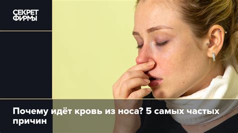 Почему идёт кровь из носа? 5 самых частых причин: Жизнь — Секрет фирмы