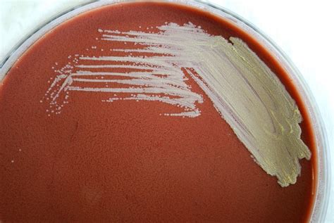 Free picture: francisella, tularensis, direct, fluorescent, antibody, stain