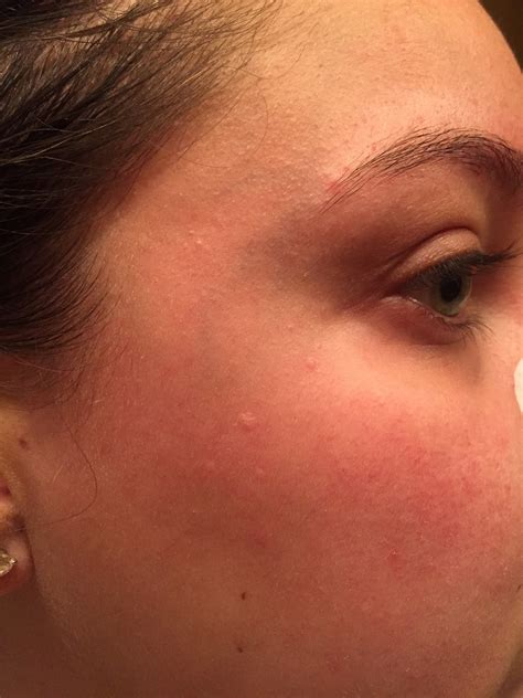 Skincare 101: Discussions, Questions and... - Beauty Insider Community