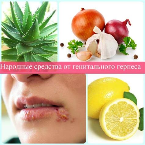 Народные средства при генитальном герпесе | Вирус Герпес