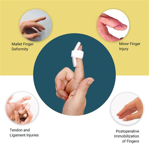 Cvs Finger Splint Kit at Sybil Downing blog