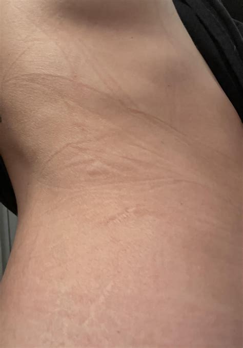 Mystery symptoms : r/Autoimmune