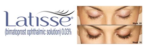Latisse Eyelash Enhancement | Advanced Skin Therapy of Smokey Point