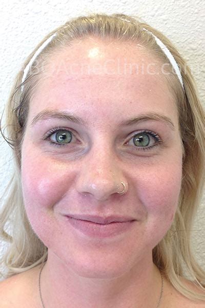 Clear Path Skin Care & Acne Clinic - Clear Path Skin Care & Acne Clinic