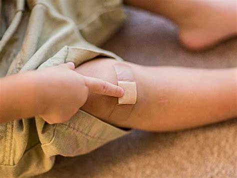 how to know if a scab is infected