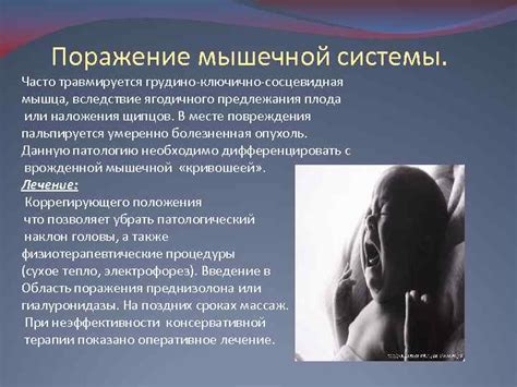 Презентация по педиатрии Тема родовые травмы новорожденных Работу