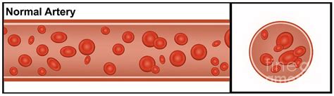 normal artery photograph  gwen shockey pixels