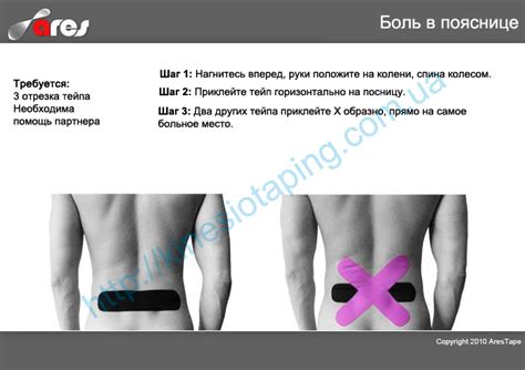 Лечение боли в пояснице методом кинезиотейпирования : Боль в пояснице ...