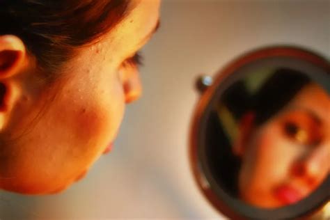 care    dealing  bad skin