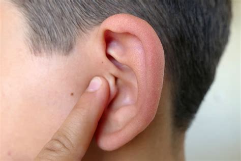 Ear Pressure: Causes, Treatment, Prevention, and More- K Health