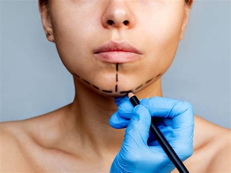 Mini Facelift Sydney | Dr Zacharia