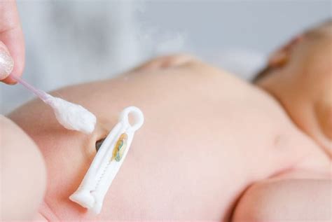 Limpeza Do Coto Umbilical - Cuidados com o Coto Umbilical - Bê à Bá da Pediatria