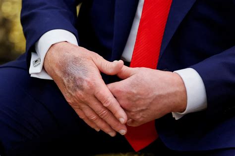 'My health is perfect' Trump says in new interview amid speculation