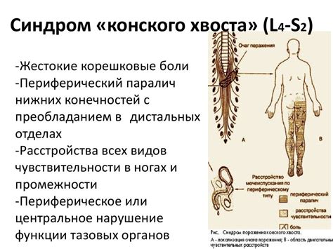 Синдромы поражения спинного мозга - презентация онлайн