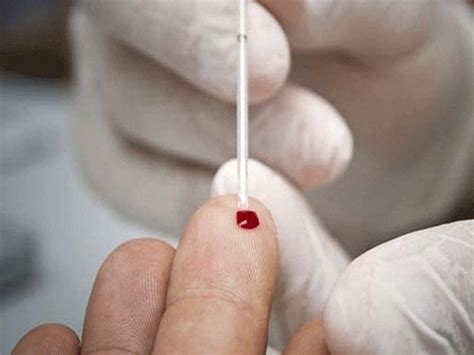 New device can detect sepsis signs from single drop of blood