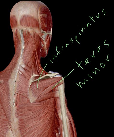 tendonitis — Victory Performance And Physical Therapy Blog | Best ...