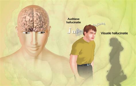 Health Condition : Symptoms, Causes, Treatment and More
