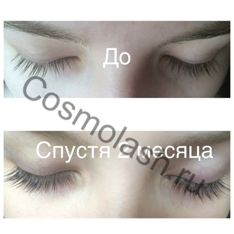 До и после применения Карепроста