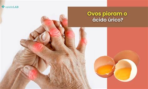 Qual O Normal Do Acido Urico - 10