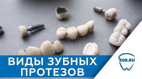 Современное протезирование зубов. Виды зубных протезов - YouTube