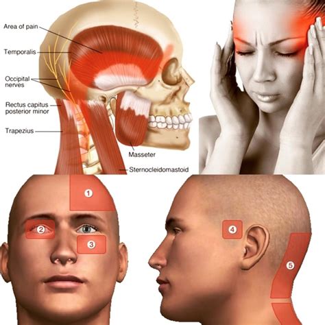 Bad Headache In Left Side Of Head Store | aria-database.com