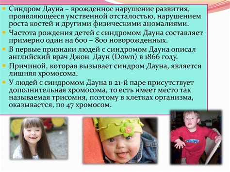 Синдром Дауна - презентация онлайн