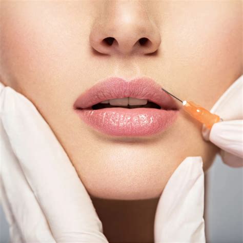 Tips to Reduce Lip Filler Swelling and Bruising | Elite Medical