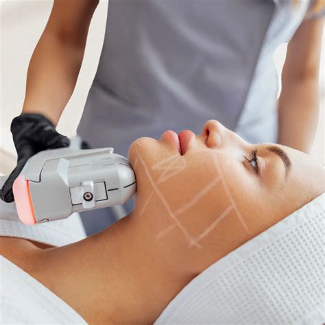 hifu face treatment 11