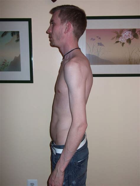 Skinny, Male body, Male