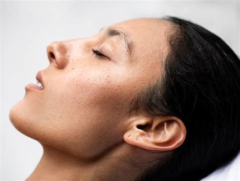 dry skin types