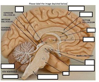 (Solved) - label the image depicted below SUPERIOR COLLICULUS INFERIOR ...