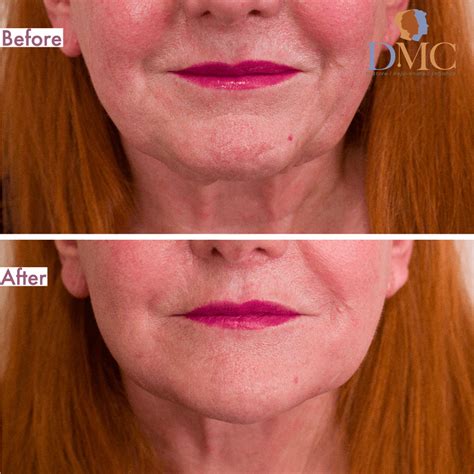 Transformation Results - Derma Medical Clinics