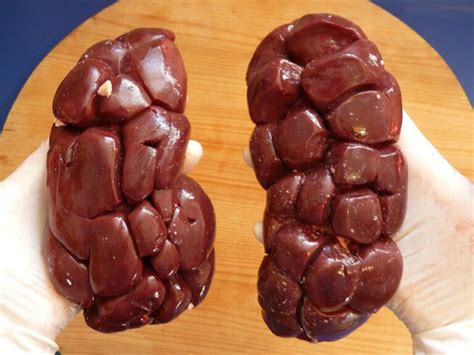 Órgão Que Filtra O Sangue - Órgão que Filtra o Sangue: Qual é e Como Funciona