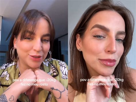 Bruna Unzueta Antes E Depois